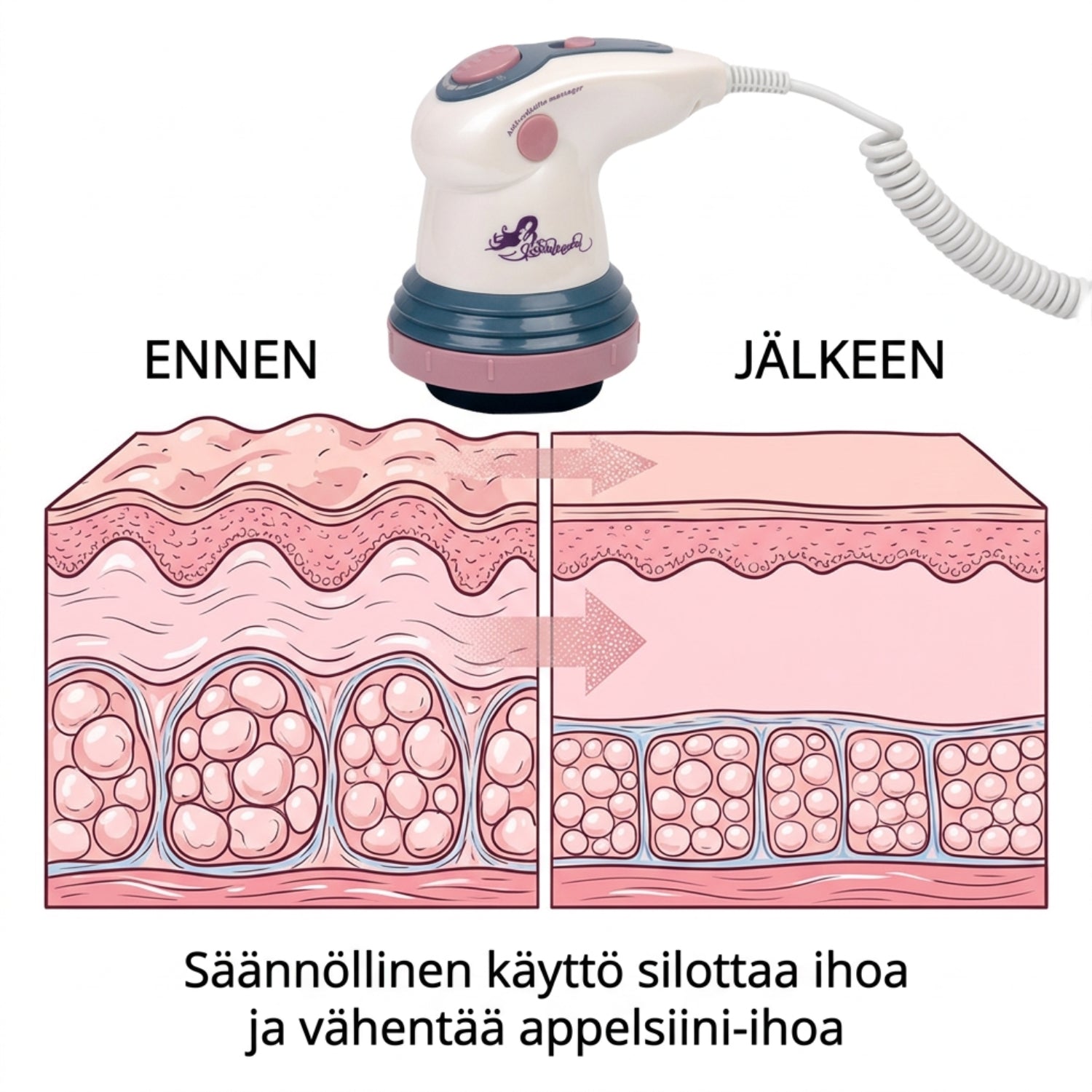 Ennen- ja jälkeen kuvat selluliitin hierontalaitteen säännöllisestä käytöstä - infograafi.